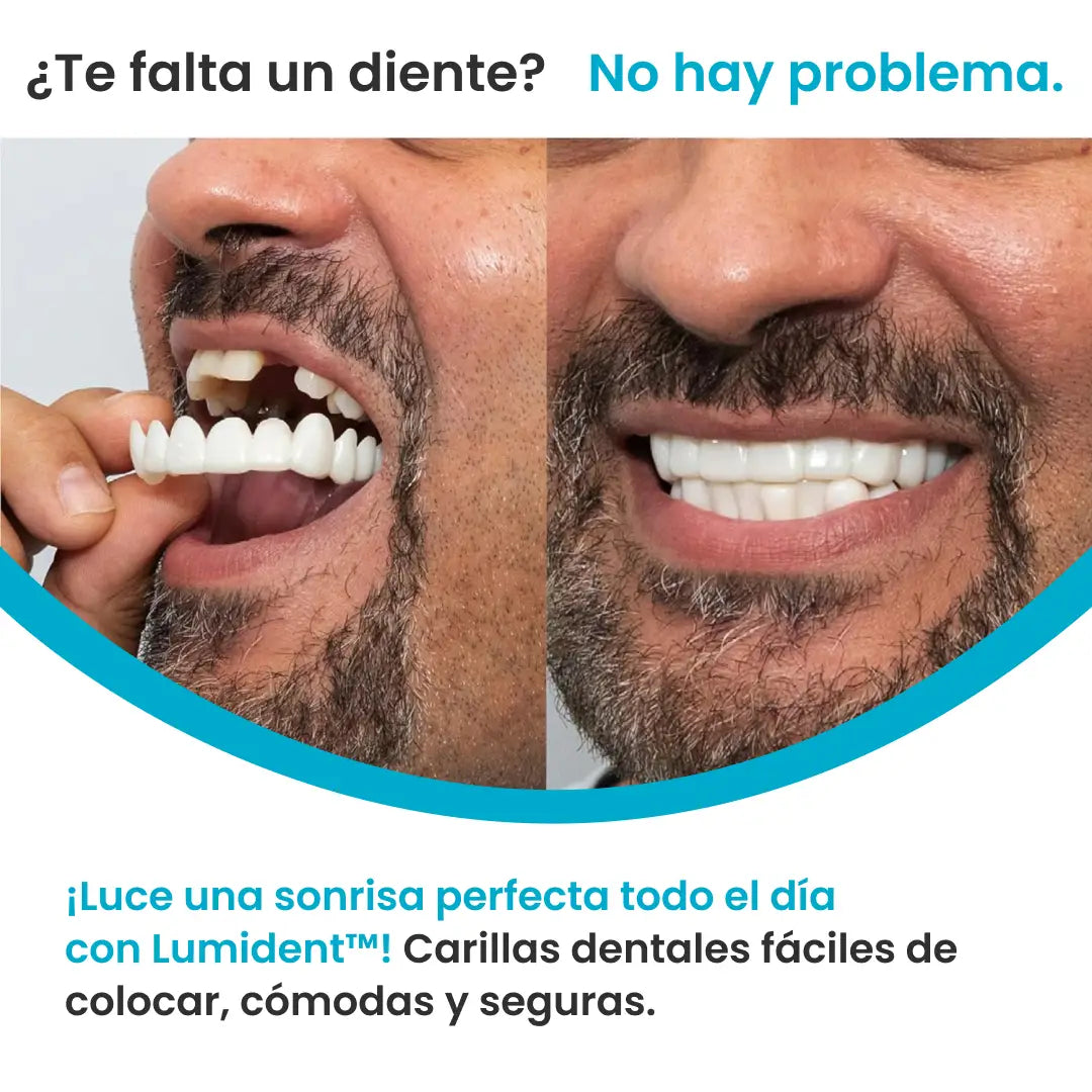 Lumident™ 2x1 - Sonrisa Perfecta en minutos